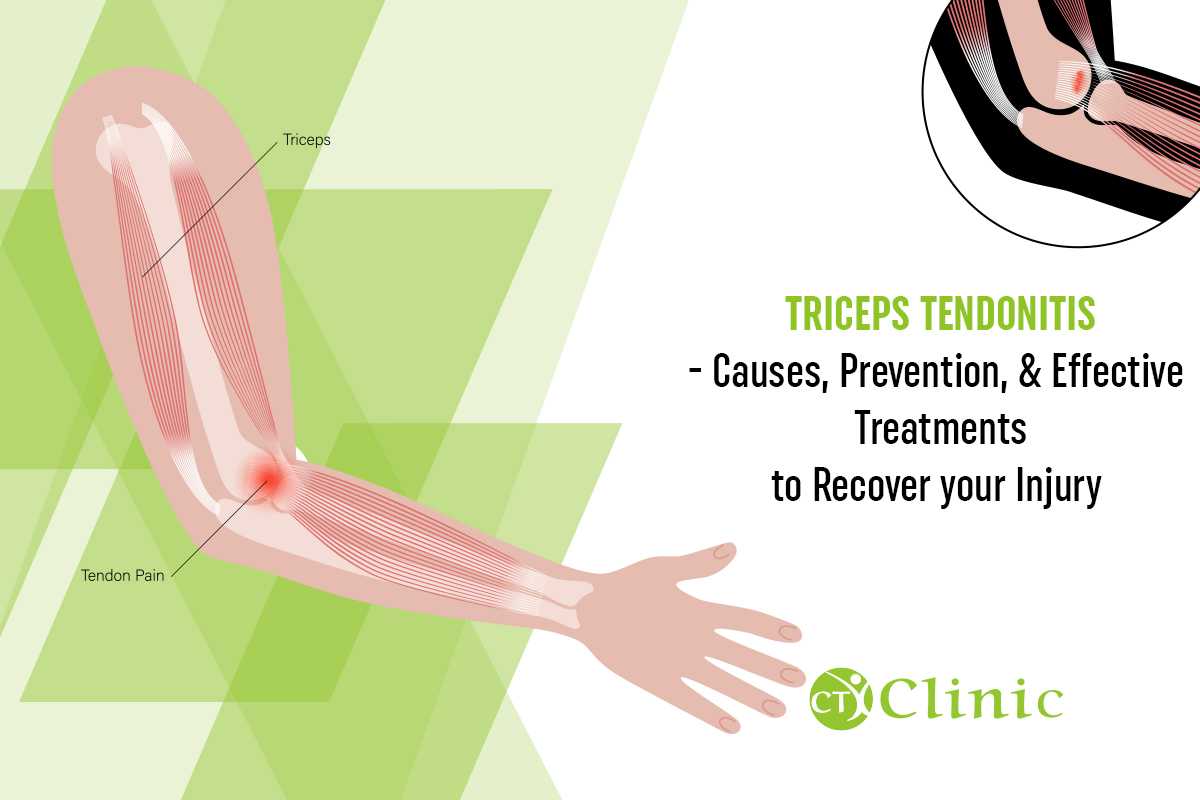 Biceps and Triceps Tendon Rupture – Core EM